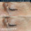 ROC DERM CORREXION DUAL CONTORNO DE OJOS PARPADO CAIDO EYE CREAM 20 ml